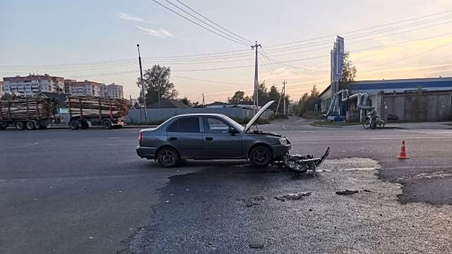 Мальчик на питбайке попал под машину в Вологде
