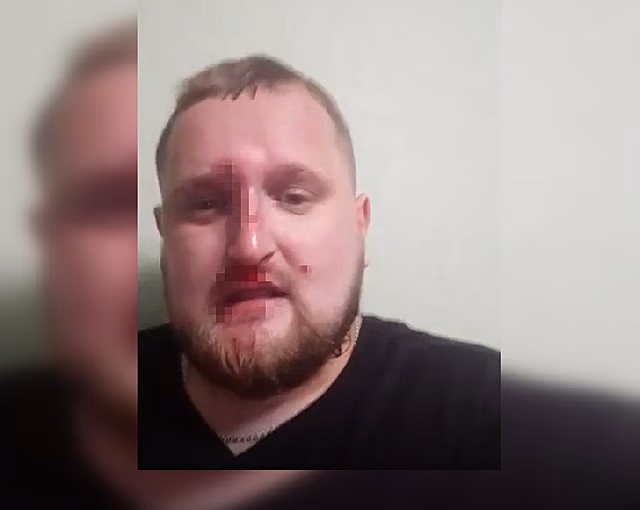 В Благовещенске неизвестные избили журналиста Андрея Афанасьева