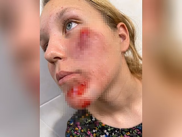 Мать сбитой в Чите триатлонистки добивается более строгого наказания водителю