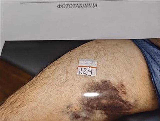 Пожилого водителя такси избил самарский "байкер"